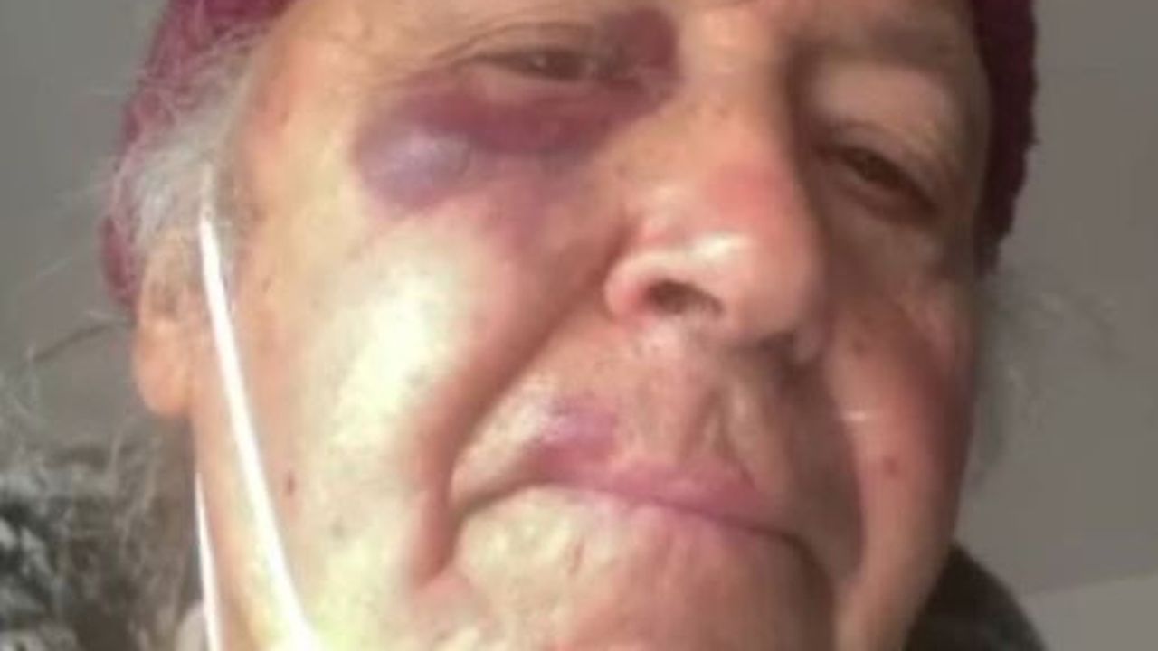 Syria, il padre picchiato per aver chiesto ad un signore di indossare la mascherina