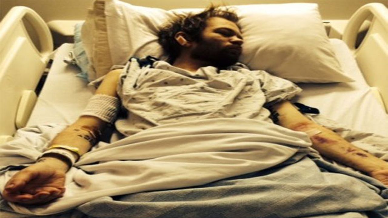 Sum 41, il cantante in ospedale con il fegato spappolato