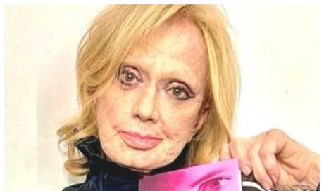Rita Pavone: età, marito, i figli e la malattia, dove vive, la chirurgia estetica